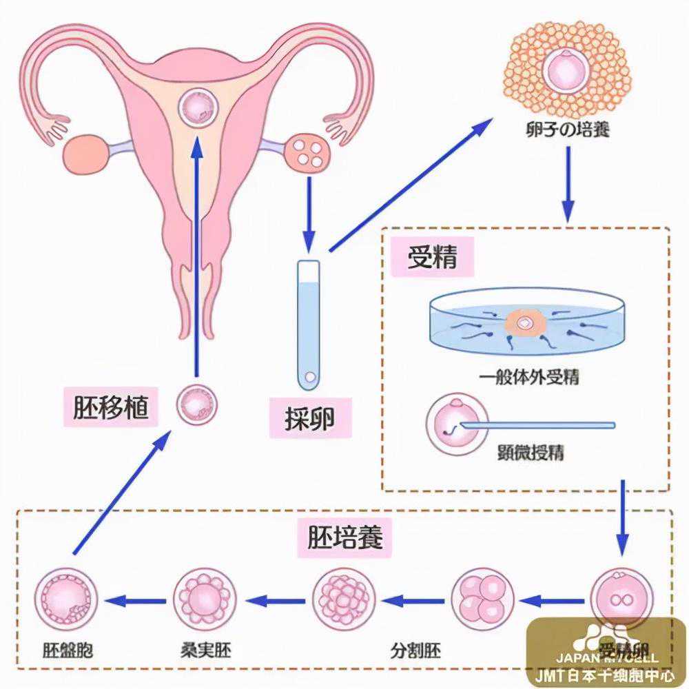 香港胎儿验血费用多少,苏州显微外科取精后辅助生殖助孕获成功